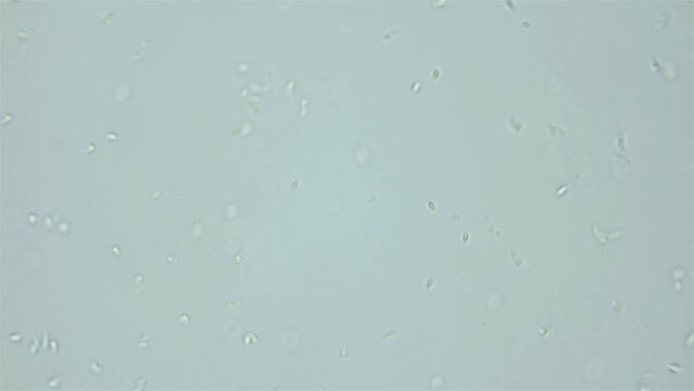 Sperm (spermotozoa) of Worm Polychaeta Nereis virens (Alitta virens) under microscope, family Nereididae. White Sea
