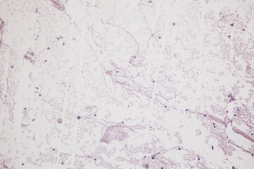Motor Neuron, Spinal cord, Nerve fibres and nerve cells under the microscope in Lab.