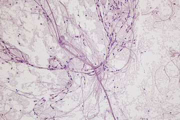Motor Neuron, Spinal cord, Nerve fibres and nerve cells under the microscope in Lab.