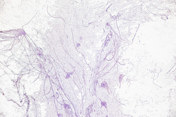 Motor Neuron, Spinal cord, Nerve fibres and nerve cells under the microscope in Lab.
