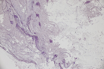 Motor Neuron, Spinal cord, Nerve fibres and nerve cells under the microscope in Lab.