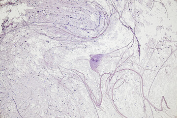 Motor Neuron, Spinal cord, Nerve fibres and nerve cells under the microscope in Lab.