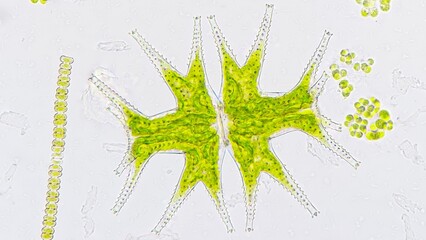 Beautiful freshwater microalgae, Micrasterias mahabuleshwarensis. Live cell. Selective focus