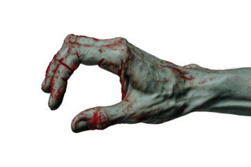 Injured hand after the accident