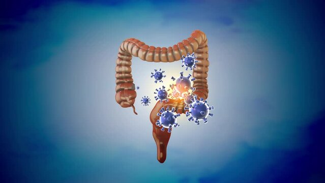 Medical concept of a large intestinal infection