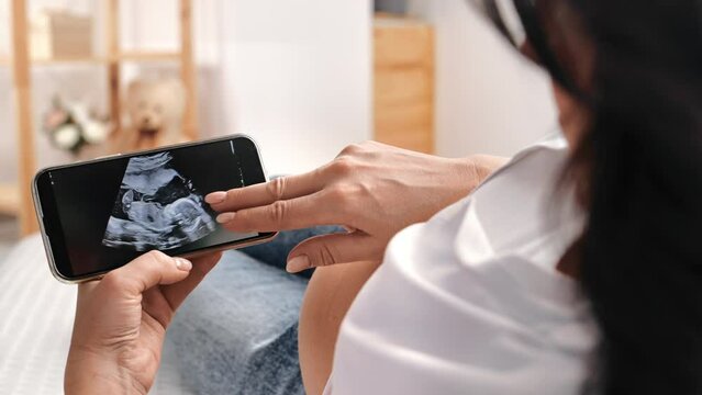 Brunette pregnant woman looking zoom at baby digital xray scan result on smartphone screen closeup