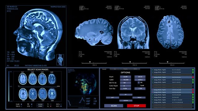 MRI brain scanning animation. Neurology data, vital signs on display Future technology. HUD, interface concept. 