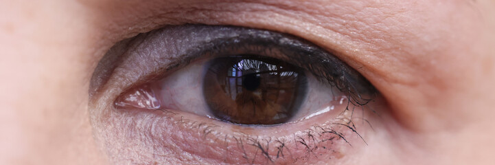Eye of adult woman with dark brown iris and hanging eyelid