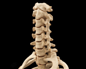 CT scan of C-Spine or Cervical spine 3D rendering  for diagnosis  fracture of cervical spine in ...