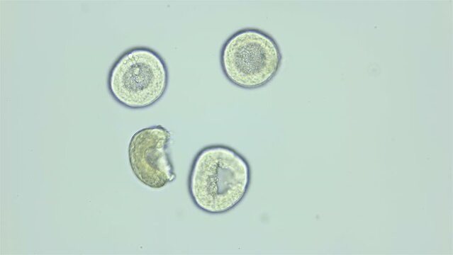 Larvae sea urchin Strongylocentrotus pallidus under microscope, phylum Echinodermata. Blastula stage, locking half. White sea