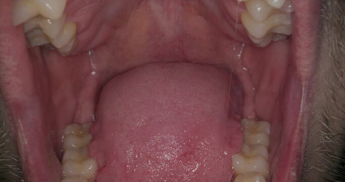 Untersuchung des Rachens beim Arzt
