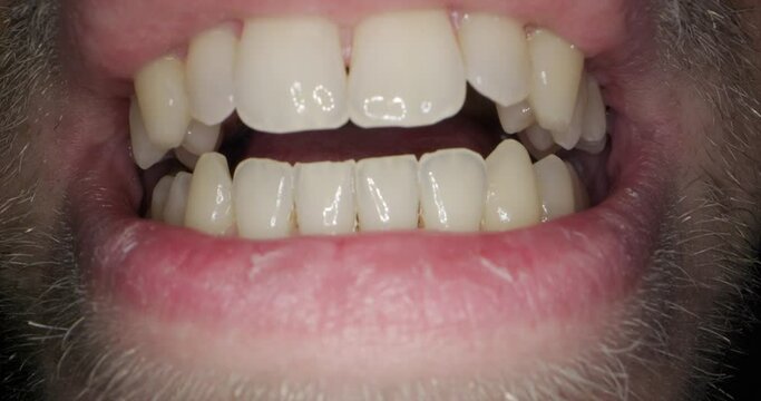 Untersuchung von Mund und Rachen beim Arzt