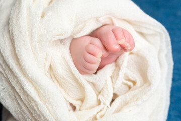 twisted child. Soft feet of a newborn.