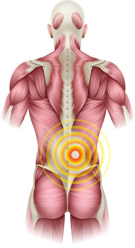Lower Back Pain Medical Anatomy Illustration