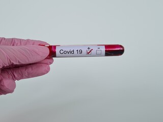 Obraz premium Test tube with coronavirus positive blood result