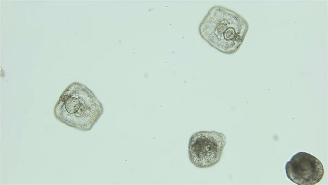 Larvae sea urchin Strongylocentrotus pallidus under microscope, phylum Echinodermata. Prism stage. White sea