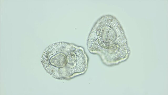 Larvae sea urchin Strongylocentrotus pallidus under microscope, phylum Echinodermata. Prism stage. White sea