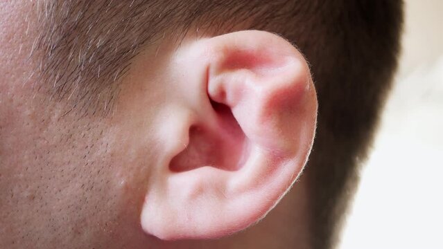 As a result of the struggle, the man's ear was damaged. Close-up of an ear with broken cartilage.