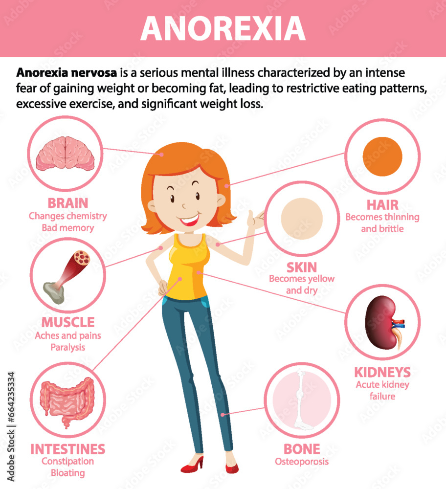 Poster Unhealthy Female Anatomy: Anorexia's Effects on Body Functions