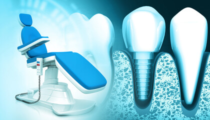 Dental chair on dental implant background. 3d illustration..