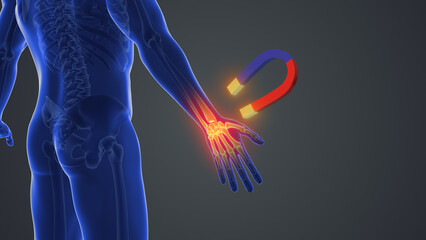 Magnet therapy for wrist joint pain	
 - obrazy, fototapety, plakaty