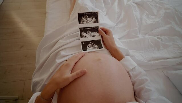 Three ultrasound fetus pictures in hand of pregnant female view from above. Future mom to be waiting for a child. Pregnancy and motherhood concept.
