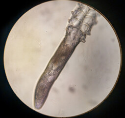 Demodex folliculorum - parasitic mite on the eyelashes of a human eye