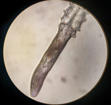 Demodex Bilder Durchsuchen 460 Archivfotos, und Videos
