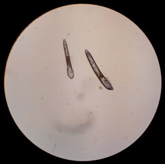 Demodex folliculorum - parasitic mite on the eyelashes of a human eye