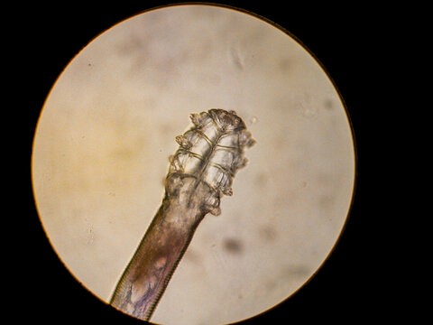 Demodex folliculorum - parasitic mite on the eyelashes of a human eye