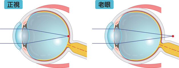 近視、遠視、老眼、乱視、myopia、hyperopia、presbyopia、astigmatism・eye・illustration