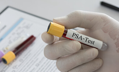 PSA test (Prostate specific Antigen) concept. Doctor holding sample blood collection tube with PSA-Test label in lab.