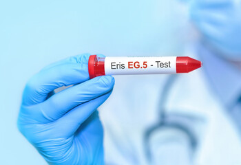 Doctor holding a test blood sample tube for the detection of the new Omicron variant Eris EG.5 on...