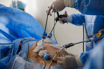 doctors perform laparoscopy operations in the intensive care unit