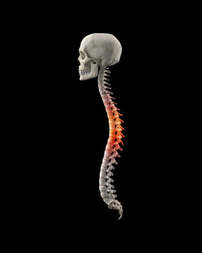 Human spine with lumbar with pain in thoracic region