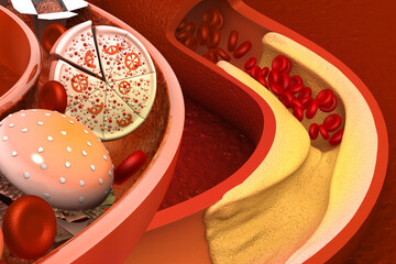 Unhealthy food with Clogged arteries. 3d illustration
