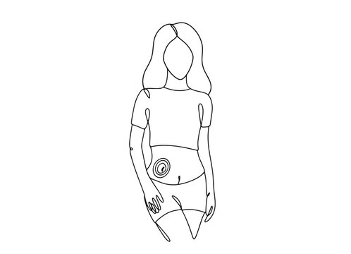 Woman. Stoma. One line