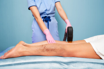 A cosmetologist does laser hair removal on woman's legs with varicose veins. Legs close-up. The...