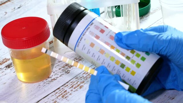Medical laboratory assistant taking test tube with liquids, test with urine, Scientist doctor looking at sample in test tube. Laboratory analysis.