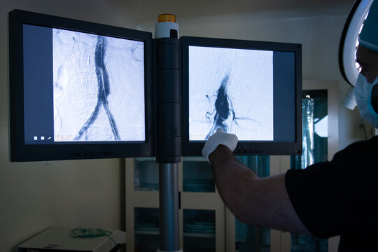 Vascular surgeon checking mointor inside operating room