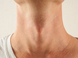 Adam's apple in a man, close-up structure of cervical cartilage organs