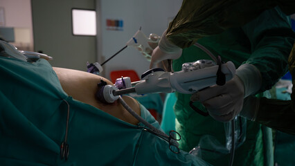 Obesity surgery. Weight loss surgery is performed with laparoscopic surgery. Operating room doctor...