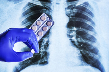 a hand in a blue medical glove holds pills in a blister against the background of an X-ray of the lungs