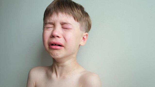 Dramatic portrait of a crying 7 year old boy. Tears flow from the eyes. The upset child. A swollen eye hurts due to a blow or insect bite. Sorrow. Children violence. Stress concept. Kids hysteria. 4K.