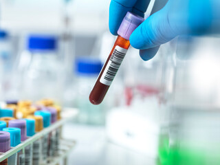 Pathologist holding blood collection tube in laboratory