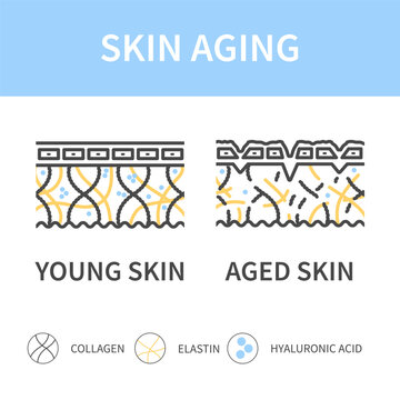 Young skin versus aged skin cross section diagram. Firm skin becoming saggy with low levels of collagen, elastin and hyaluronic acid. Linear vector illustration.