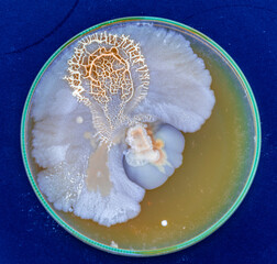 colonies of bacteria and microorganisms on the surface of agar and wind during microbiological...