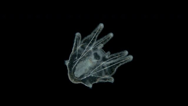 Larva sea urchin Strongylocentrotus pallidus under microscope, phylum Echinodermata. Arm pluteus stagee. White sea