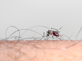 mosquito sucking blood on human skin .
