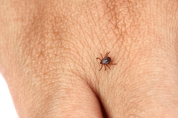 Tick crawling on human skin